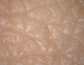 Multi-lighting image of skin texture (skin replica)